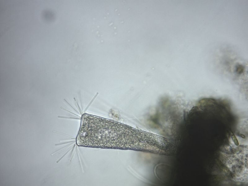 Tokophrya infusionum